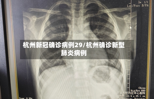 杭州新冠确诊病例29/杭州确诊新型肺炎病例