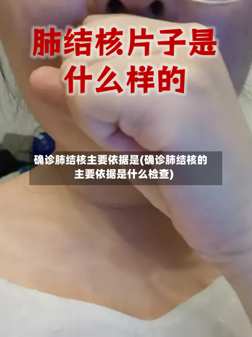 确诊肺结核主要依据是(确诊肺结核的主要依据是什么检查)-第2张图片